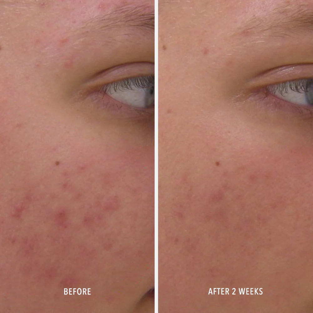 Hydro Peptide Clear Rescue Serum