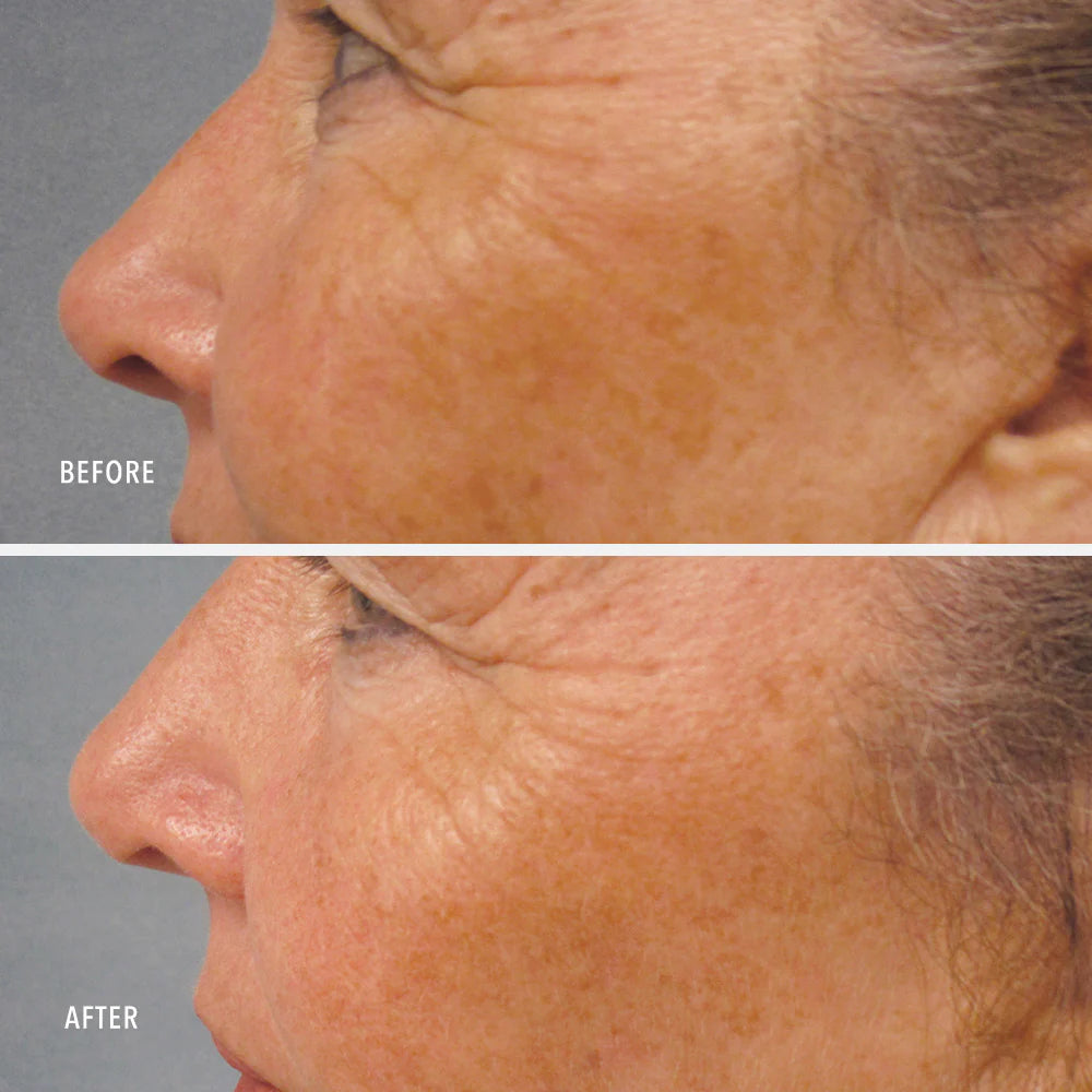 Hydro Peptide LUMAPRO-C SERUM