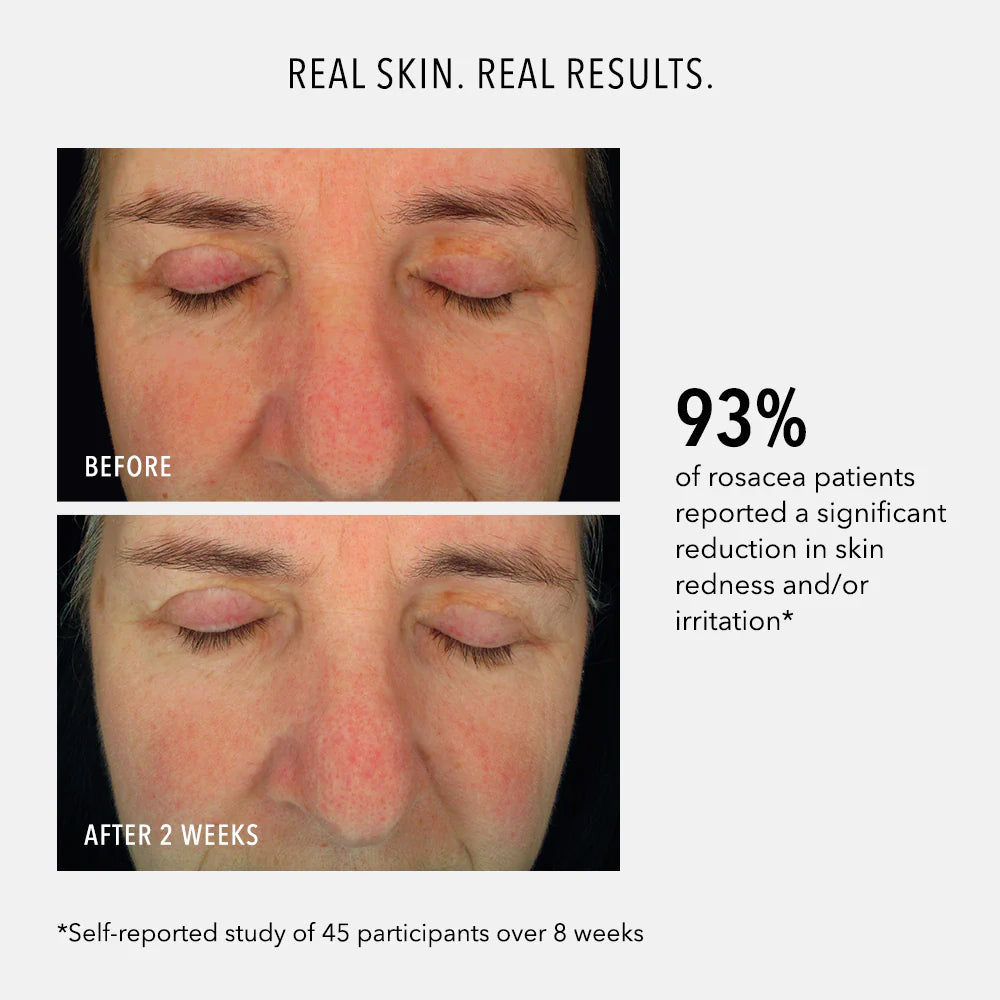 Hydro Peptide Soothing Serum