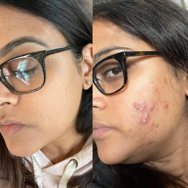 Hydro Peptide Face Lift